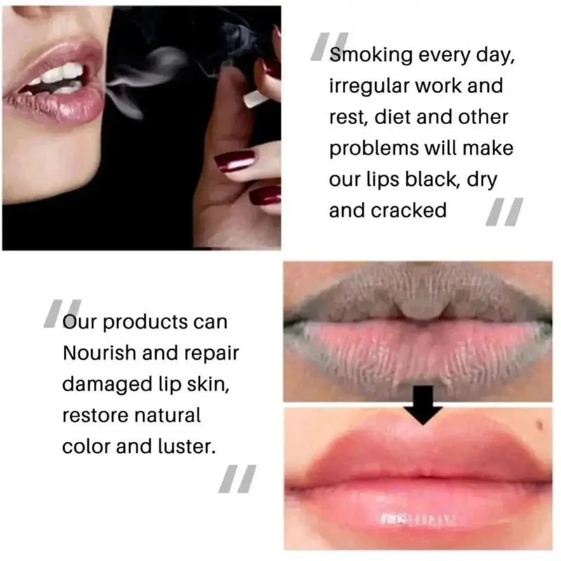 Masque Lèvres & Baume Réparateur – Soin Nourrissant Quotidien - vue produit 5