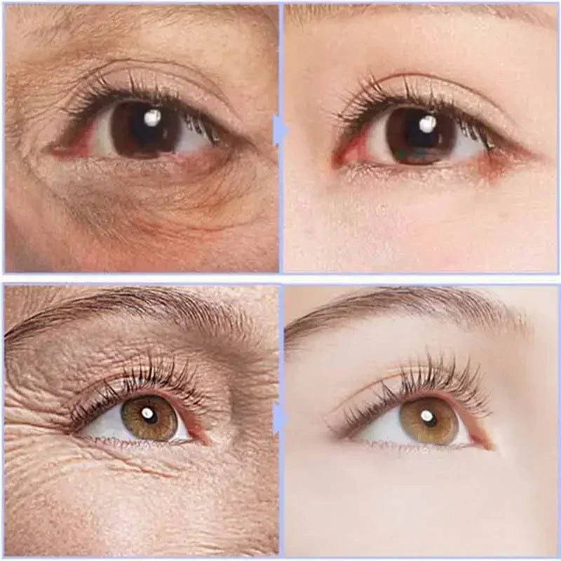 Crème Contour des Yeux Effet Lift Instantané – Anti-Poches & Anti-Cernes - vue produit 3
